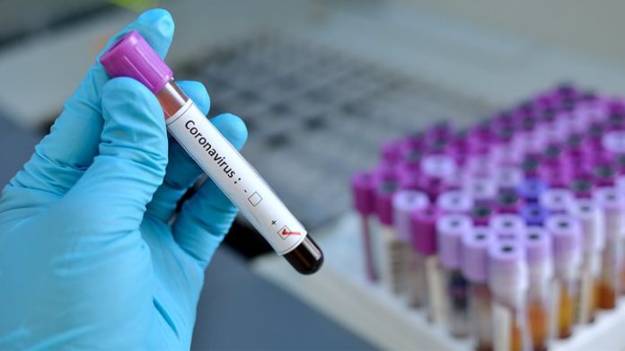 coronavirus_deads