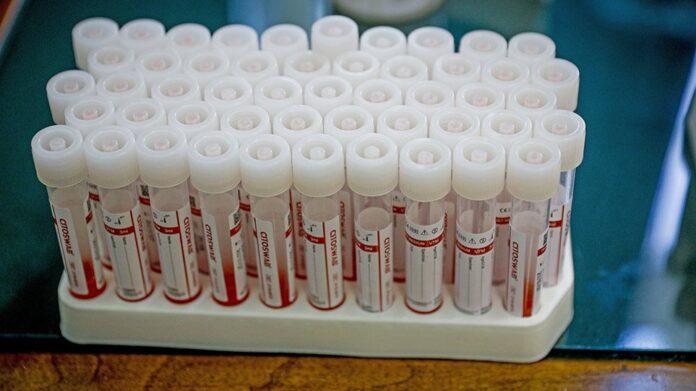 koronoios-test-arthro