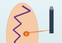 Laser Θεραπεία Κιρσών και Αγγειακές Παθήσεις: Ο Ρόλος του Αγγειοχειρουργού