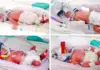 Σπάνια πανομοιότυπα τετράδυμα γεννήθηκαν στην Αυστραλία – Η έκπληξη της γιατρού